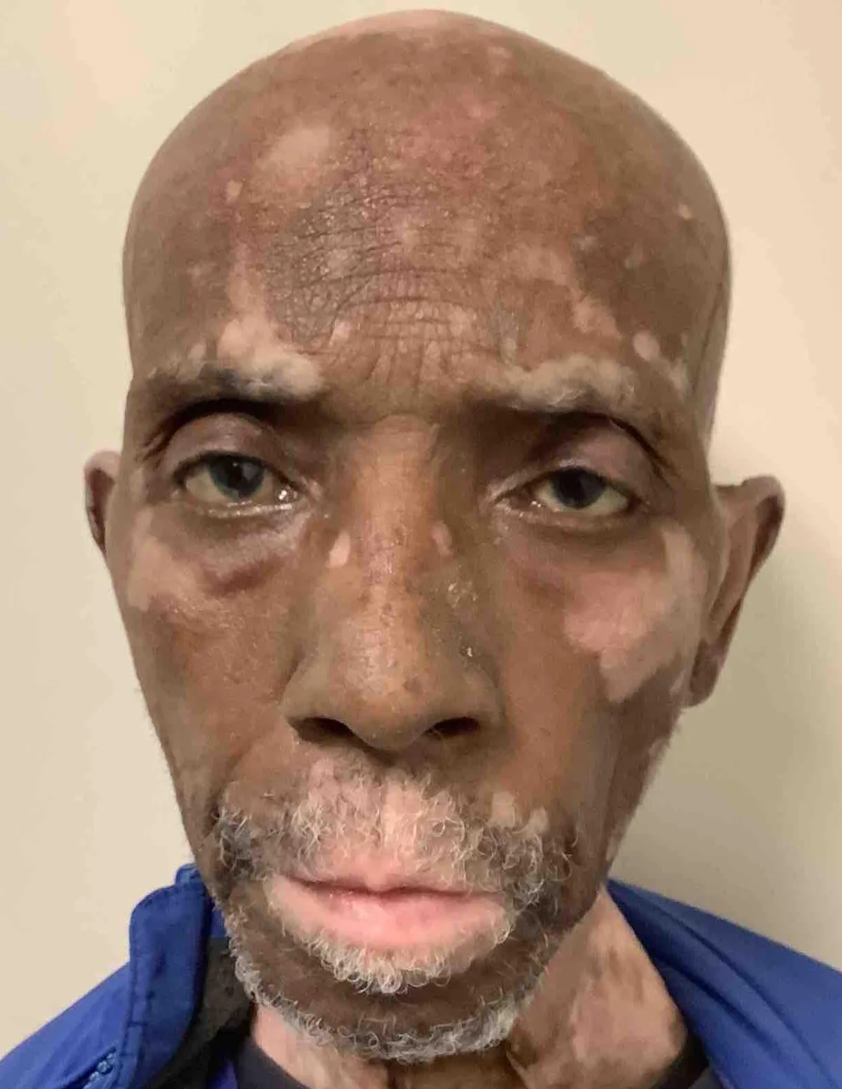 Registry photo of Harold Scharkley