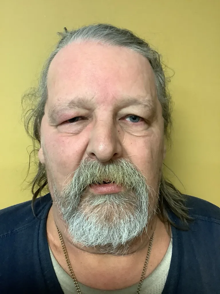 Registry photo of Walter William Hitzeman