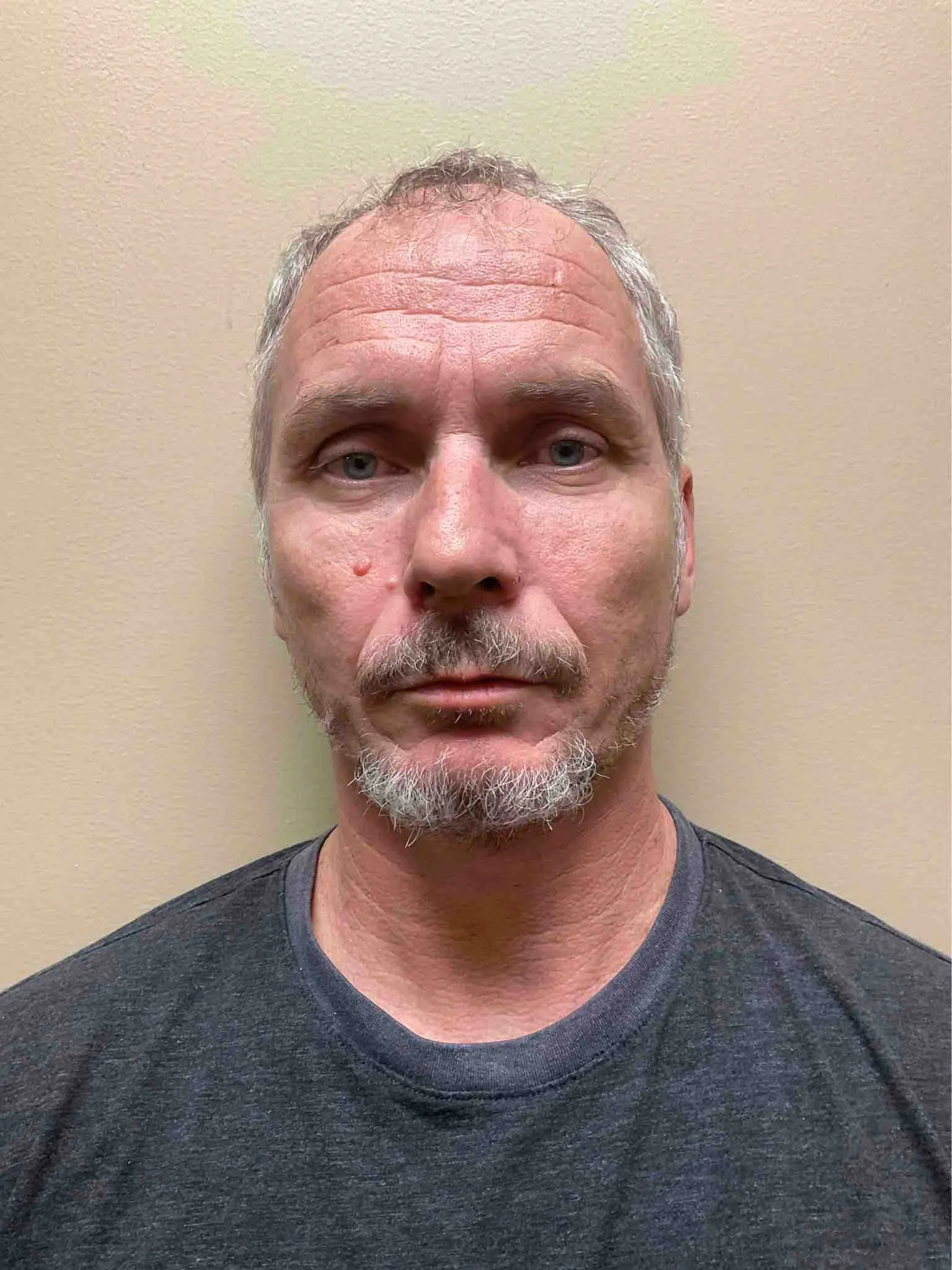 Registry photo of Albert W Skinner