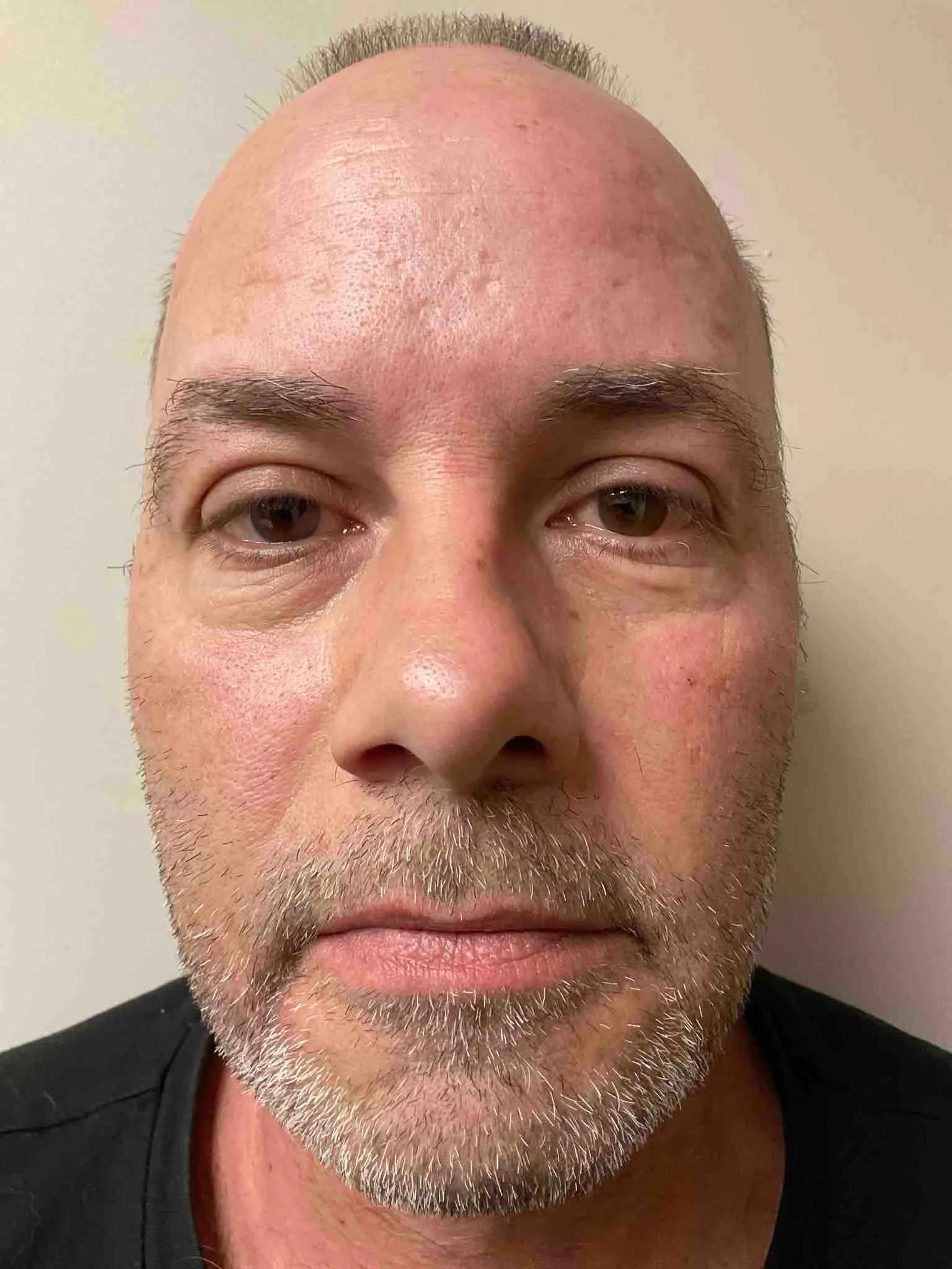 Registry photo of Dennis Eugene Harmon