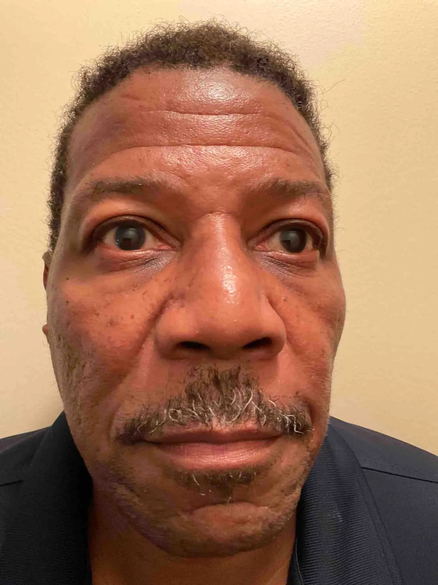 Registry photo of Tony Rozelle Hoover