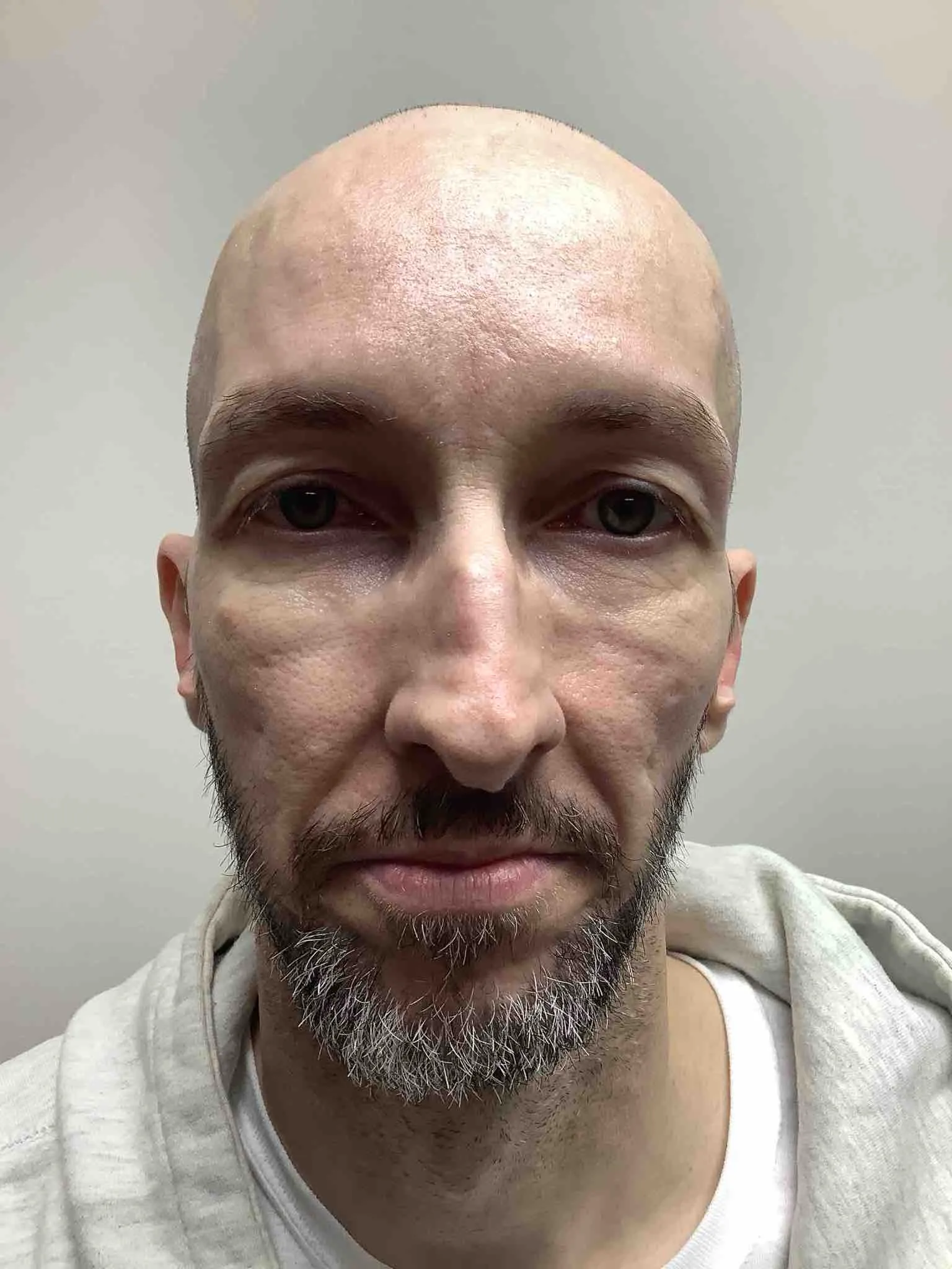 Registry photo of Robert Fred Knittel