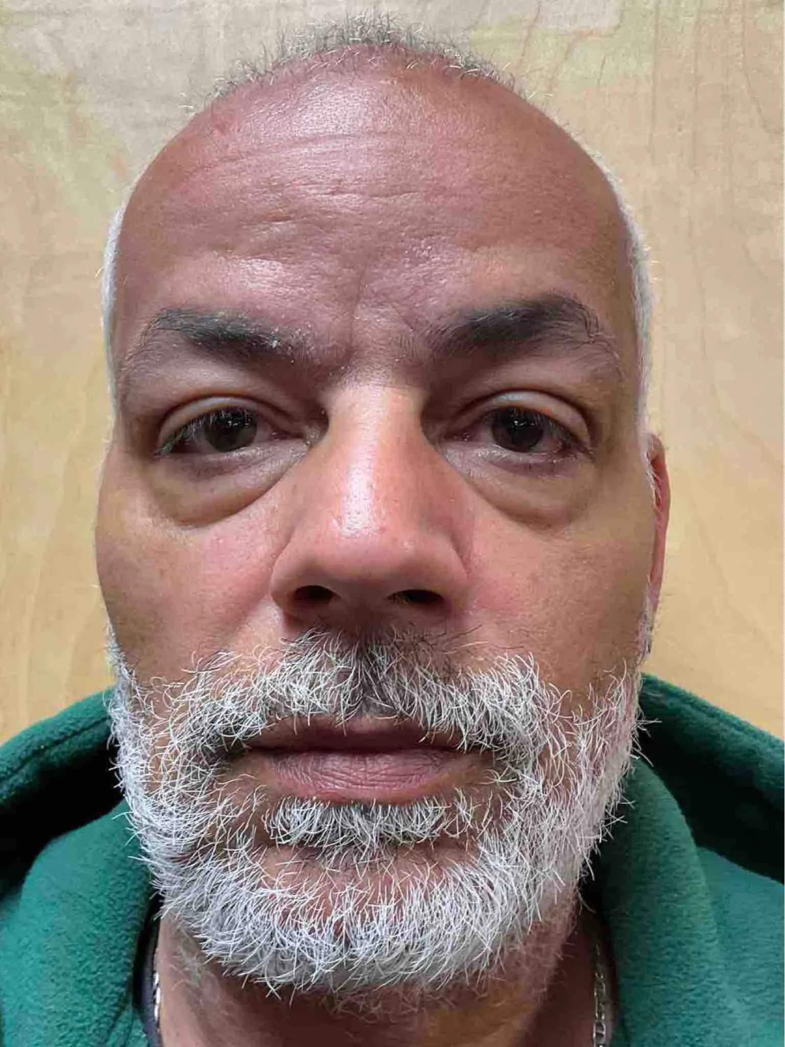 Registry photo of Anthony Allen Hansen