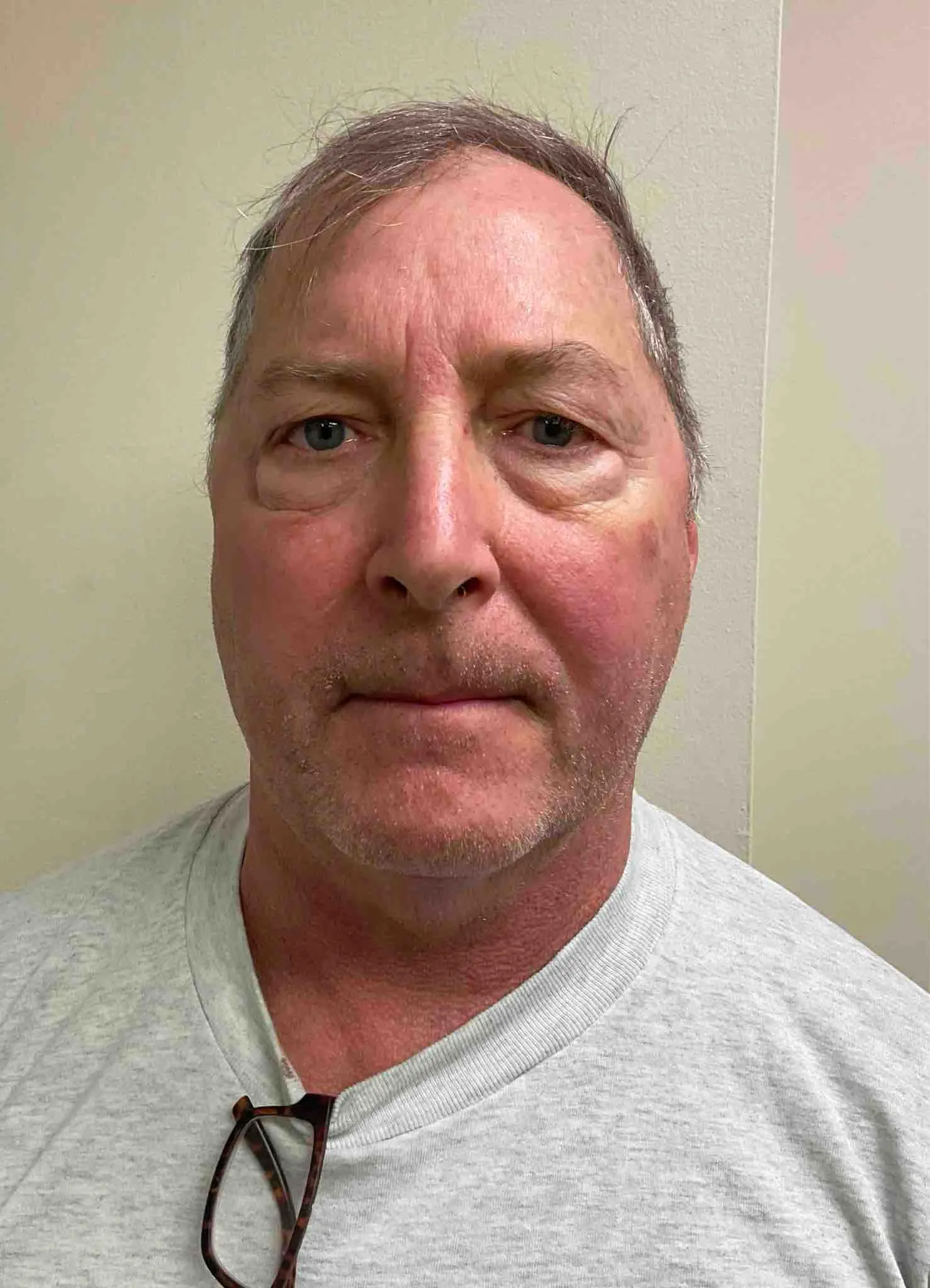 Registry photo of John Lynch