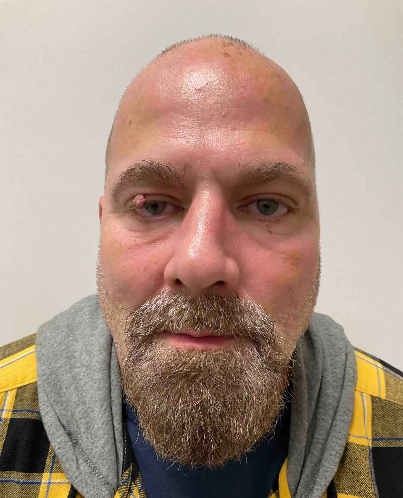 Registry photo of John Forrest Lane