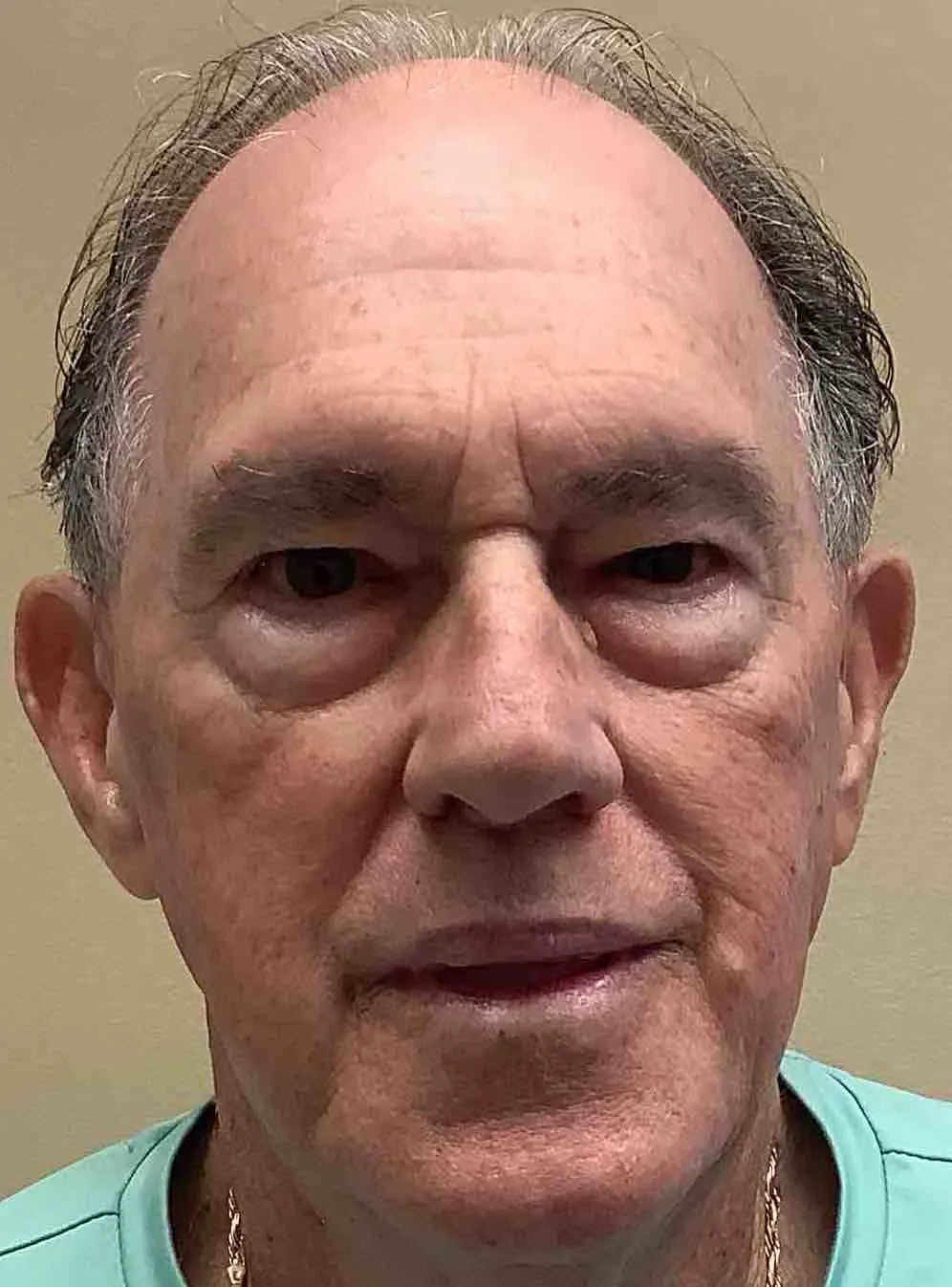 Registry photo of Hobart Lee Burns