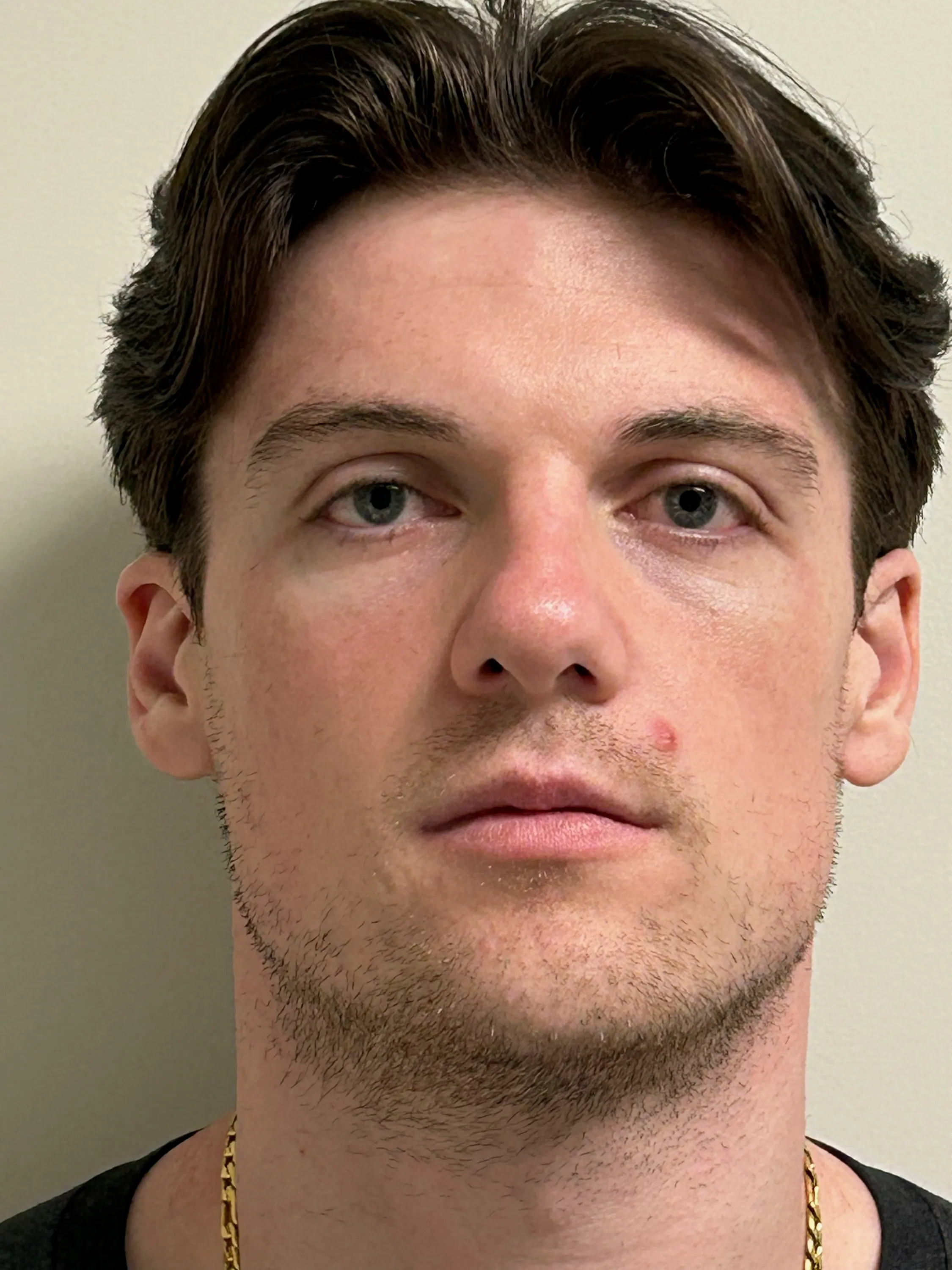 Registry photo of Christopher Gunner Scholato