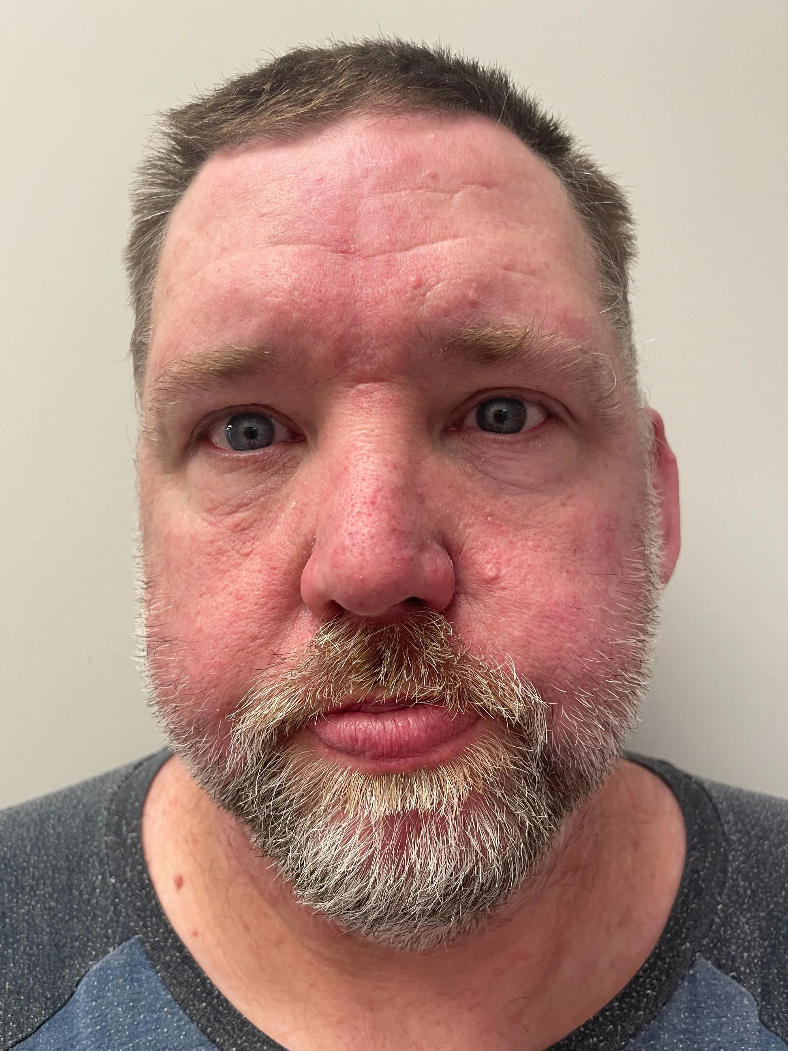 Registry photo of John Dinkins