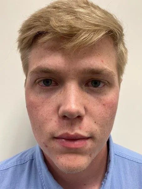 Registry photo of Blaise Daniel Ochs