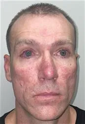 Registry photo of Franklin Delano Cartledge